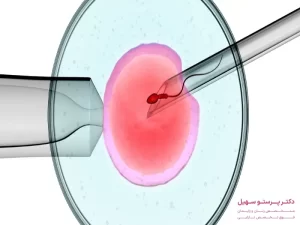 درمان نازایی با آی وی اف
