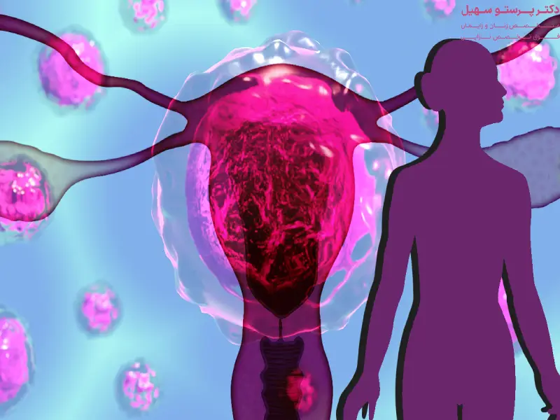 بهترین قرص برای تنبلی تخمدان