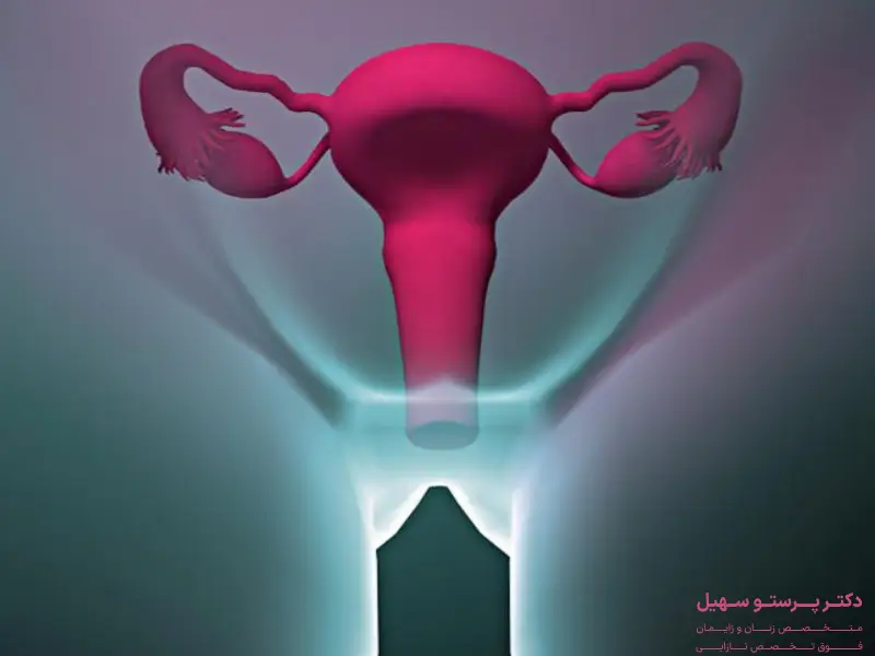 عوارض بعد از هیستروسکوپی