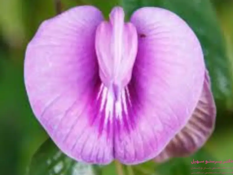 بخیه بعد از لابیاپلاستی