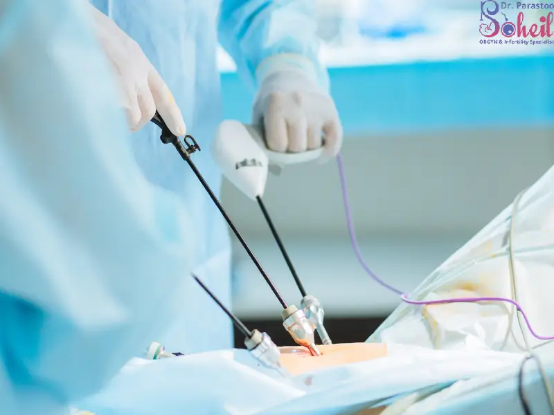 بهترین جراح لاپاراسکوپی زنان در تهران