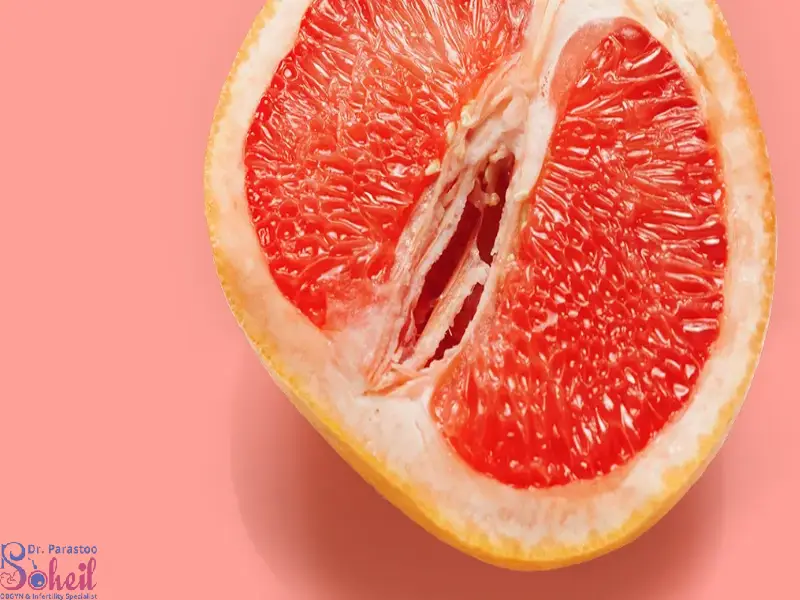 خونریزی بعد از لابیالاستی