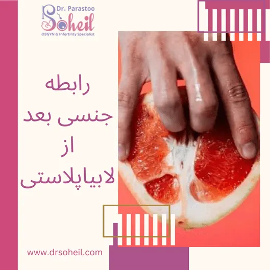 رابطه جنسی بعد از لابیاپلاستی