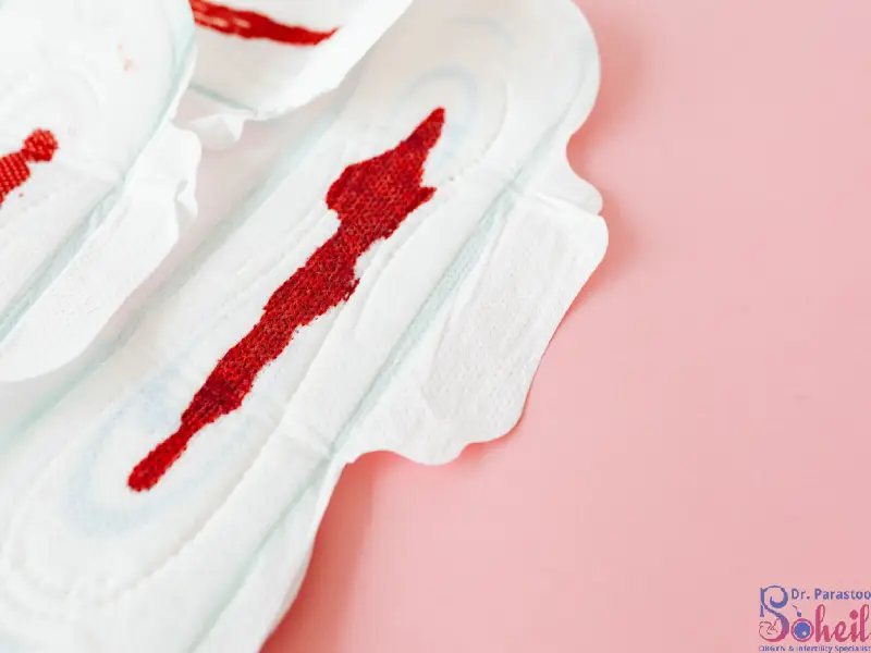 خونریزی شدید در پریودی